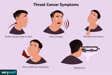 Throat Cancer Signs