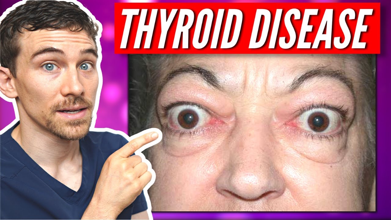 Thyroid Disease And Hives Symptoms Causes Treatment