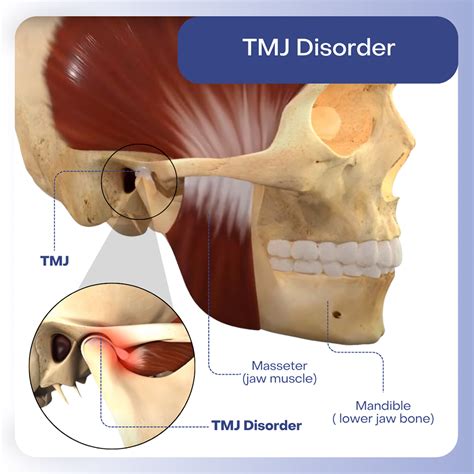 Tmj Treatment Valdosta Ga Advanced Dental Care Tmd