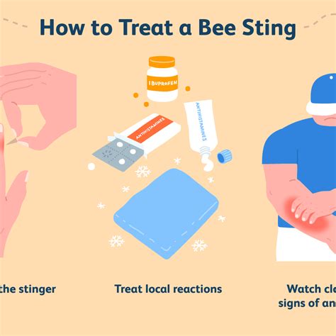 Treatment For Yellow Jacket Sting Parents Republic Treatment For Yellow Jacket Sting Parents Republic