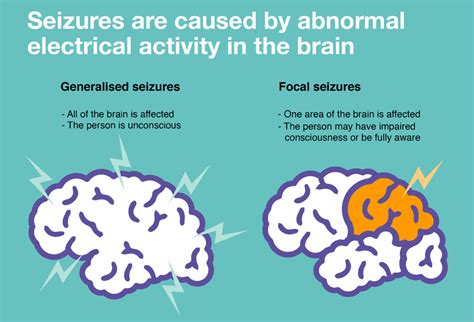 Types Of Seizures And Their Symptoms South Valley Neurology Neurologists Types Of Seizures And Their Symptoms South Valley Neurology Neurologists