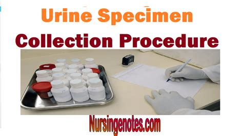 Urine Specimen Collection Procedure Male Female And Infants Urine Specimen Collection Procedure Male Female And Infants