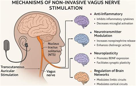 Vagus Nerve Stimulation Implant Praised By Depression Patient