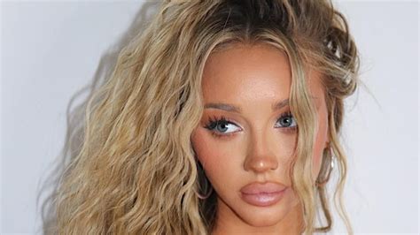 Vanna Before Surgery: What to Expect and How to Prepare