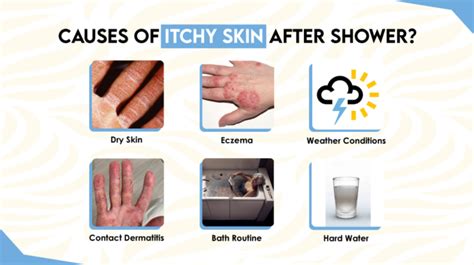 What Causes Itchy Skin After A Bath At Ray Roger Blog