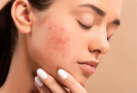 What Causes Scabs On Face And How To Treat Them