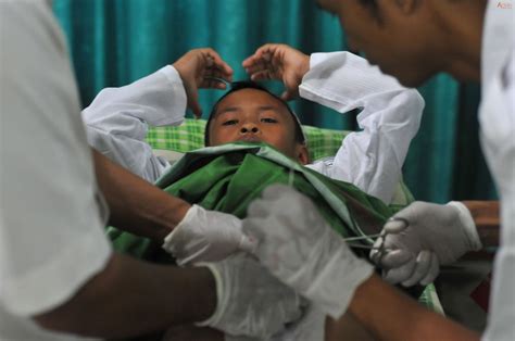 What Is A Circumcision