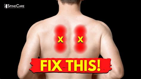 What Is A Sharp Pain In The Shoulder Blade At Alison Mclemore Blog