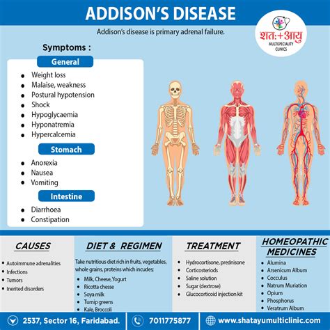 What Is Addison S Disease Symptoms Causes Diagnosis Treatment And What Is Addison S Disease Symptoms Causes Diagnosis Treatment And