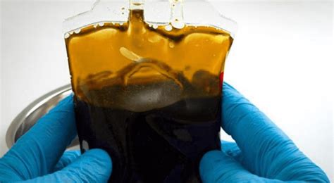 What Makes The Golden Blood The Most Precious Blood On Earth Quora