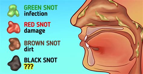 What Snot Is And What Its Color Means 5 Minute Crafts