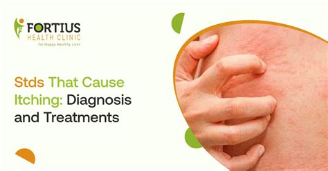 What Std Causes Itching