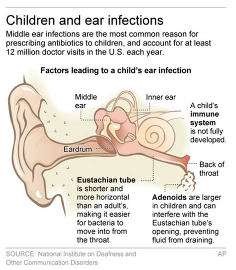 What To Know About Antibiotics For Ear Infections