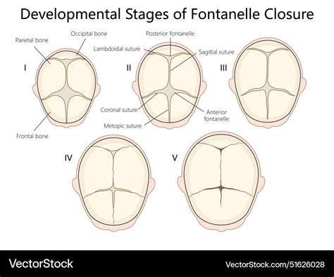 When Does Anterior Fontanelle Close