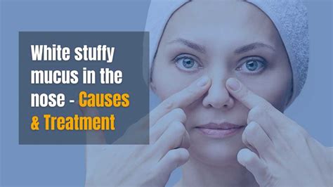 White Sticky Mucus In The Nose Causes And Treatments Wapomu Health