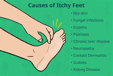 Why Do My Feet Itch So Bad Foot And Ankle Center Of Lake City
