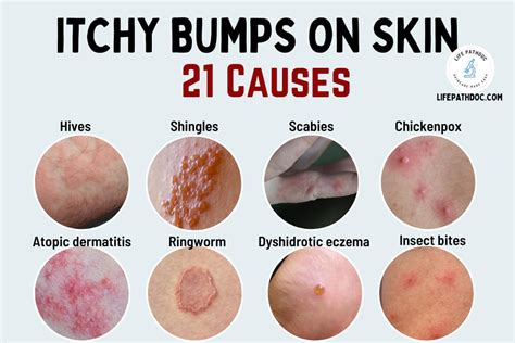 Why Does My Skin Itch Common Causes
