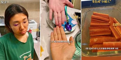 Woman In China Turns Orange After Eating Carrots For 3 Months Straight Woman In China Turns Orange After Eating Carrots For 3 Months Straight