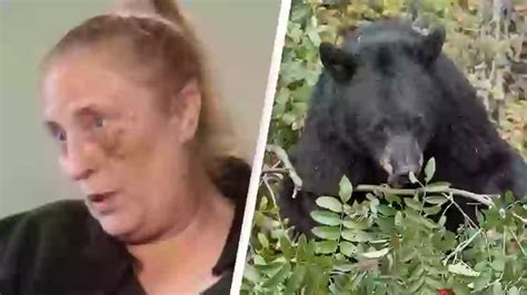 Woman Made Chillingly Calm 911 Call After Being Mauled By A Bear For 30 Minutes
